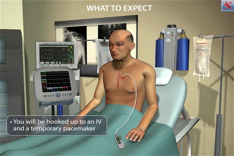 ArchieMD IC Health Coronary Bypass screenshot 3