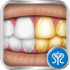 Virtual Teeth Whitening