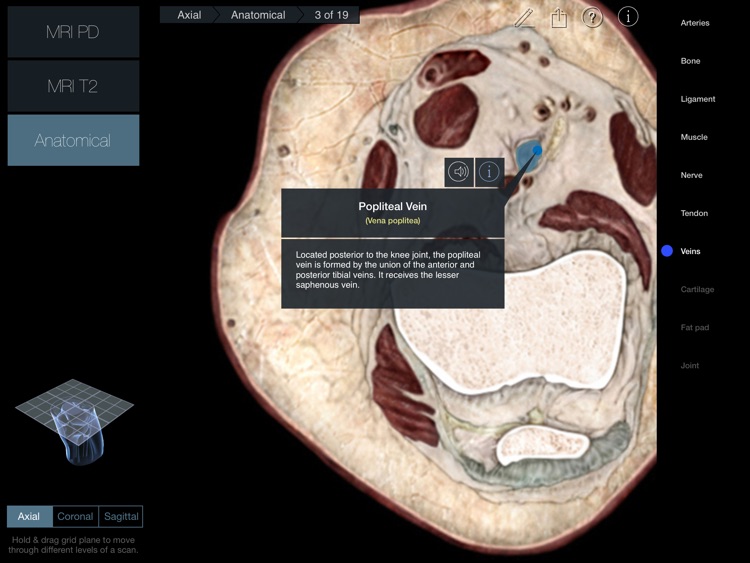 Radiology - Knee screenshot-4