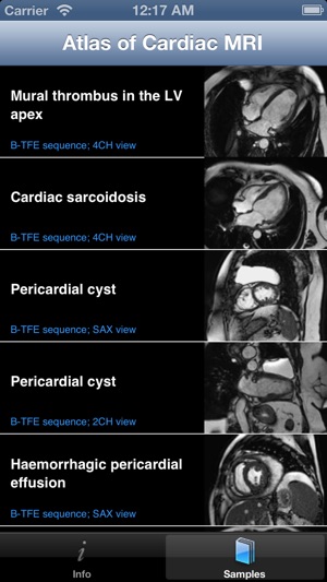 CARDIO3® Atlas of Cardiovascular Magnetic Resonance(圖1)-速報App