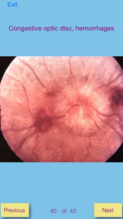 Ophthalmic Pathology screenshot-3