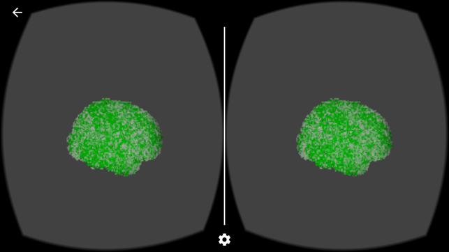 Interactive Brain Activation for fMRI Data(圖3)-速報App