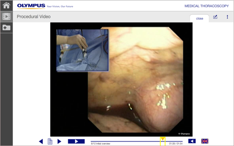 MedThora - Medical Thoracoscopy Under Local Anaesthesia screenshot 3