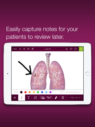 ONCsultation – Draw, Discuss & Share Medical Illustrations & Resources With Oncology Patients screenshot 4