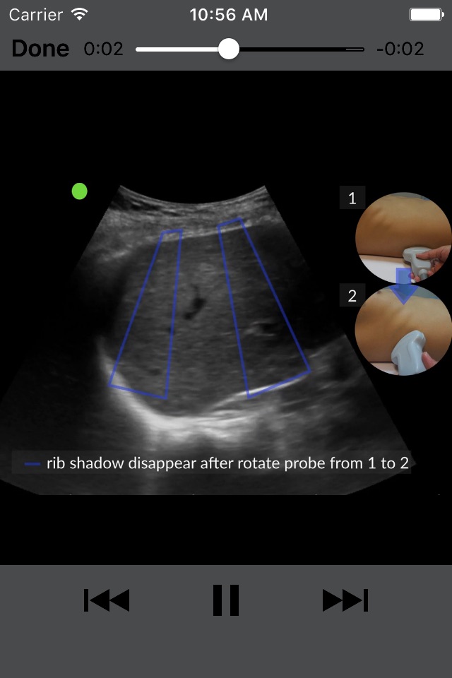 RESUS Ultrasound LITE screenshot 3