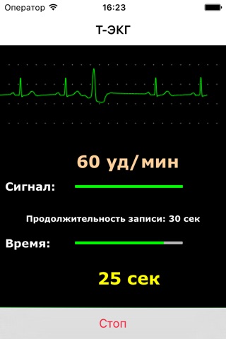 T-ECG BIOSS User screenshot 2