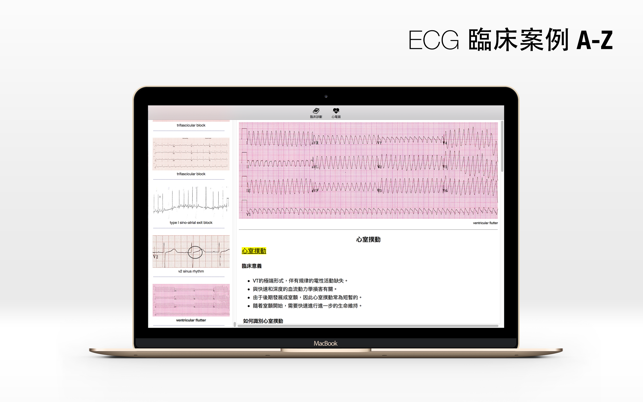 ECG A-Z(圖2)-速報App