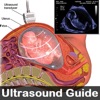 Ultrasound Guide Case Studies