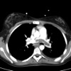 CT Scanning in Critical Care