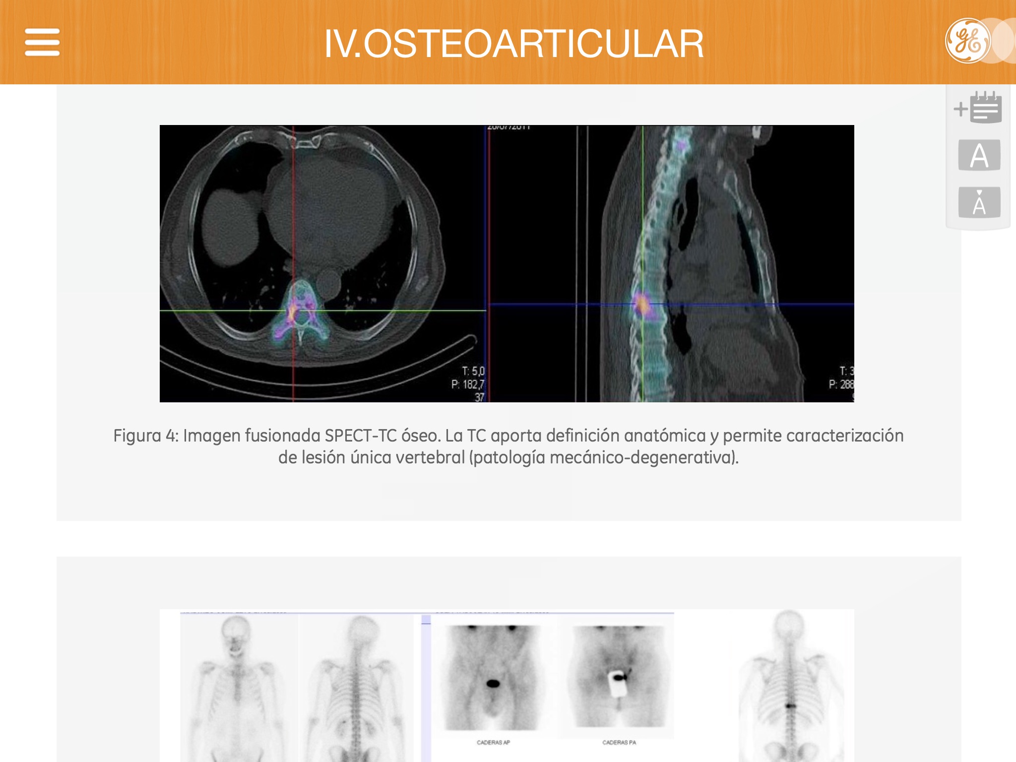 Manual de Medicina Nuclear screenshot 4