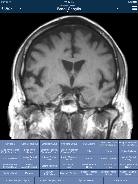 Nina: Neuroimaging In Neurology App (Full Version)