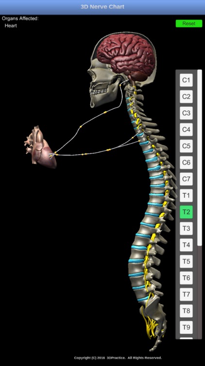 3D Nerve Chart