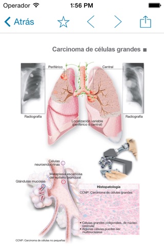 Miniatlas Lung Cancer screenshot 3