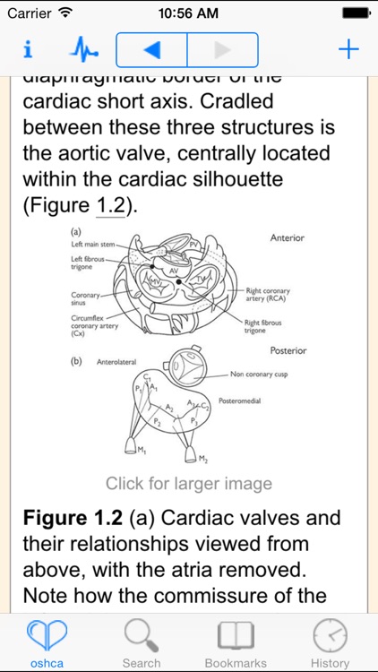 Cardiac Anaesthesia