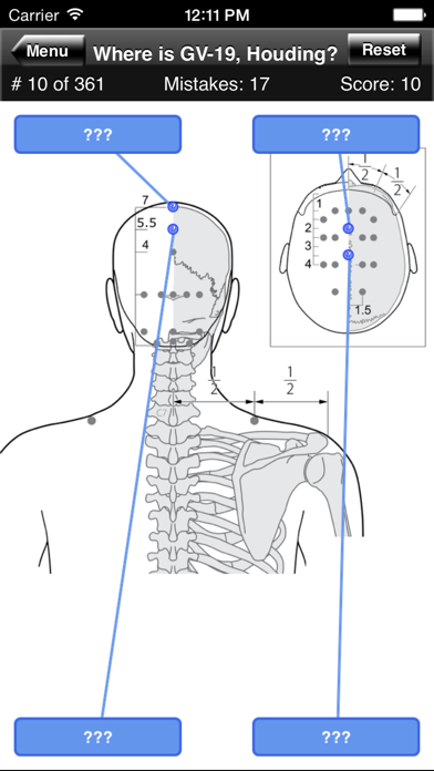 How to cancel & delete Acupuncture Points Body Quiz from iphone & ipad 4