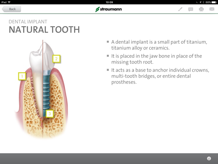 Straumann® Patient Education App