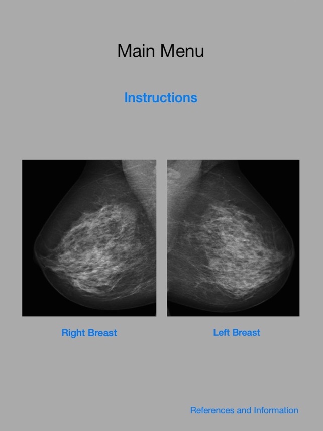 Mammography Localizer(圖4)-速報App