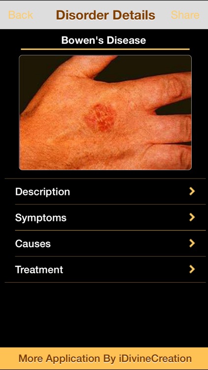 Most Skin Disorders