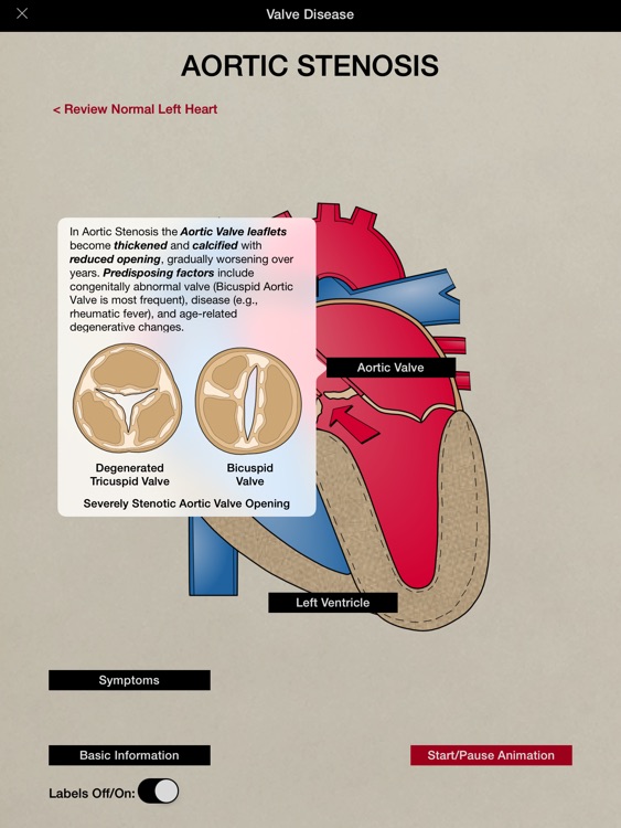 HeartCharts