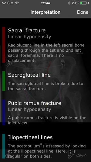 RealWorld Orthopaedics(圖3)-速報App