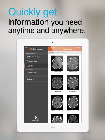 Medical Imaging screenshot 4