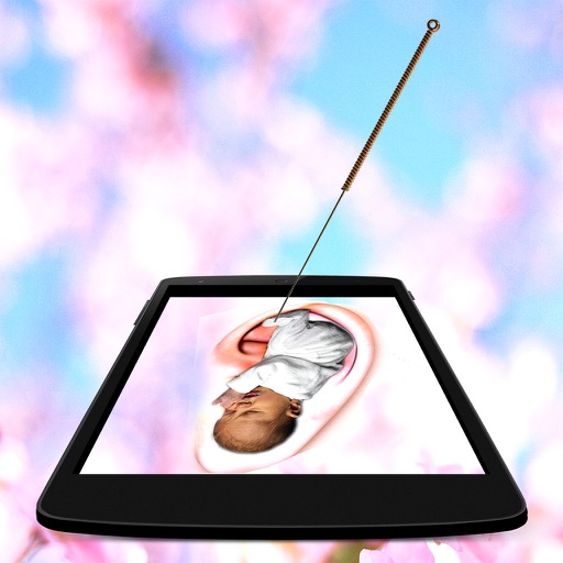 AcuMapa: Easy Acupuncture
