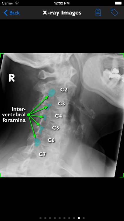 iSpineCare screenshot-4