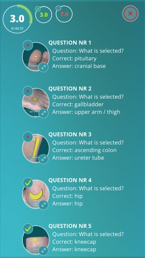 Reflexology Quiz - zones(圖4)-速報App