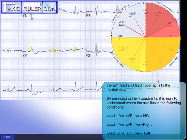 ECG Genius(圖2)-速報App