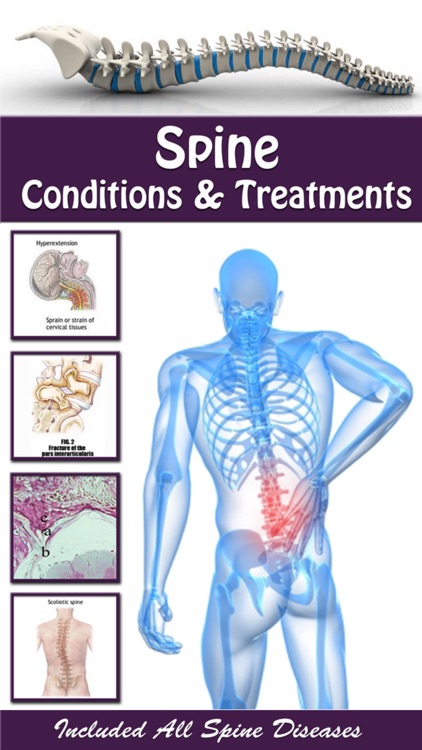 Spine Conditions & Treatment