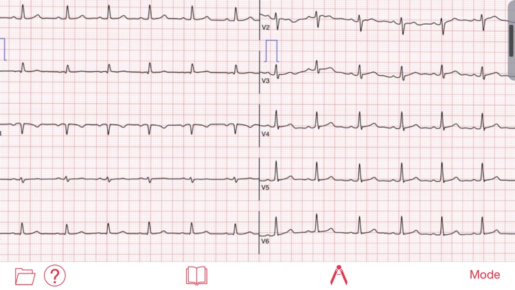 Photo EKG
