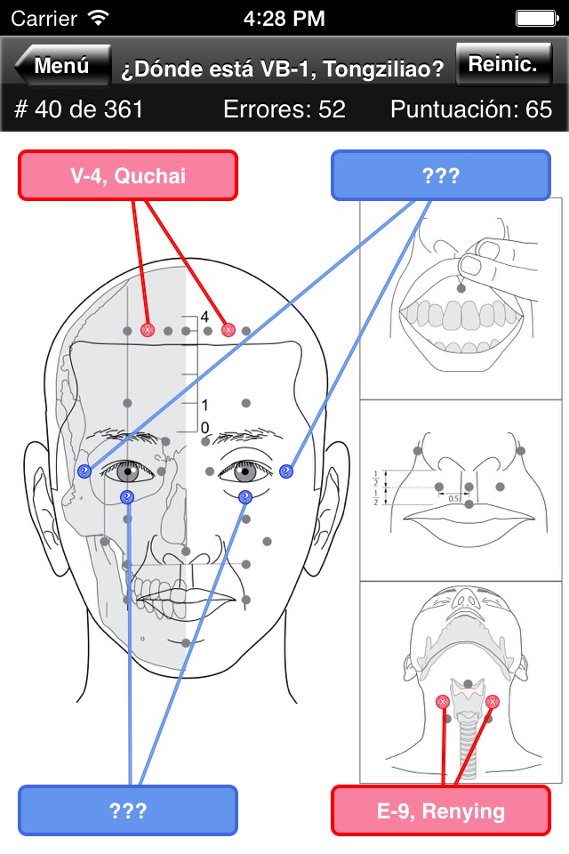 Acupuncture Points Body Quiz screenshot 3