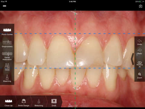 SmileHD screenshot 3