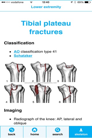 Fractures screenshot 2