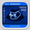 Ultrasound Pregnancy Prank