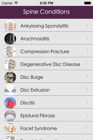 Spine Conditions & Treatment screenshot 2