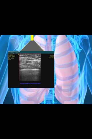 Ultrasound ABC... screenshot 2