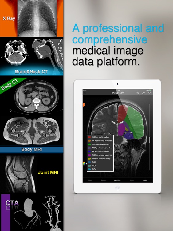 Medical Imaging