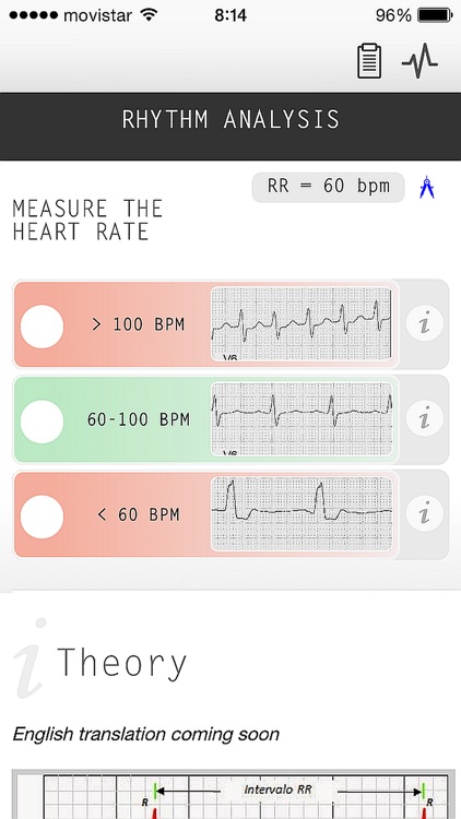 ECG Camera