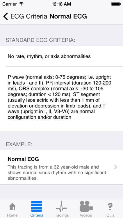 ECGsource