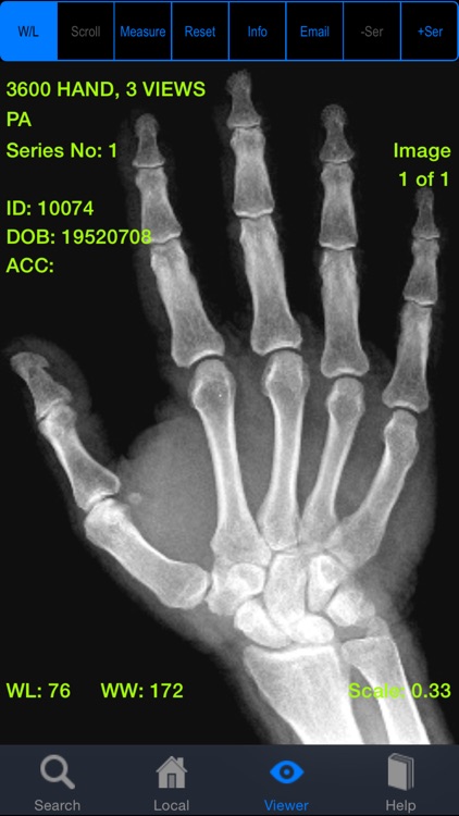 iClarity: Advanced Medical Imaging Viewer and Image Management Tool screenshot-4