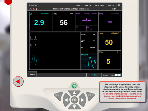Cheetah Medical's Advanced Hemodynamic Monitoring System screenshot 3