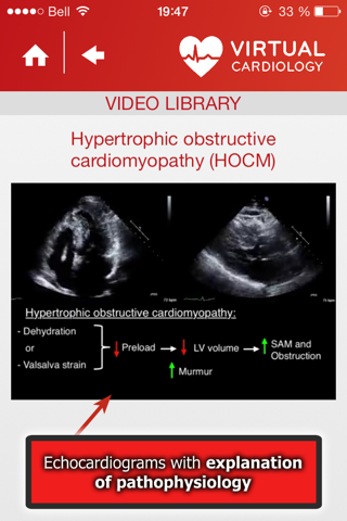 Virtual Cardiology by McGill University cardiologists and cardiologists from‎ Université Laval screenshot 4