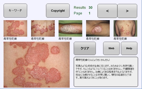 YSP Dermatology Image Database for iPhone screenshot 2