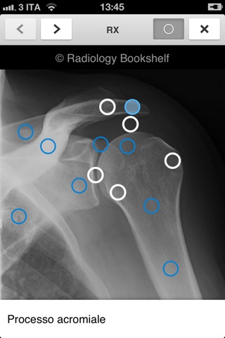 Radiology Bookshelf: Apparato Muscoloscheletrico screenshot 3