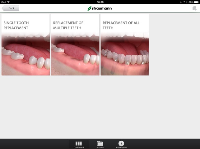 Straumann® Patient Education App(圖3)-速報App