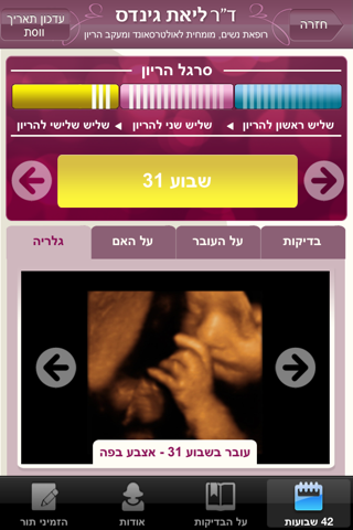 הריון screenshot 3