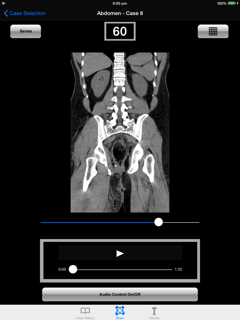 CT scanning in Critical and Emergency Care screenshot 3