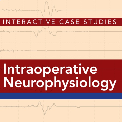 Intraoperative Neurophysiology: Interactive Case Studies by Alan D. Legatt, MD, PhD icon