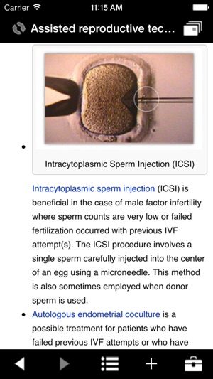 IVF(圖4)-速報App